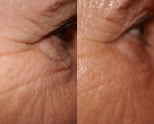 Mei Zen Cosmetic Acupuncture